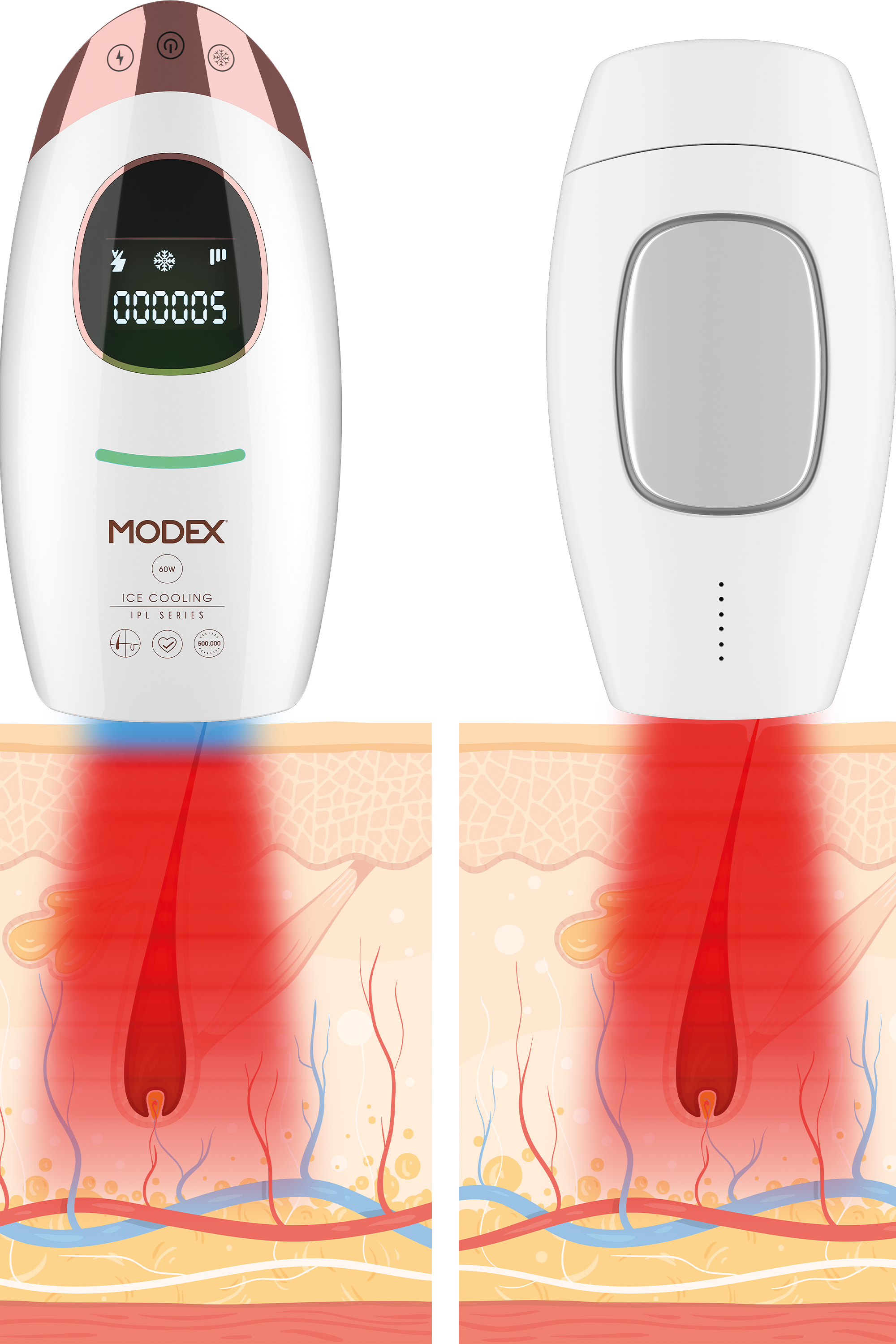 إزالة الشعر بالليزر IPL1000