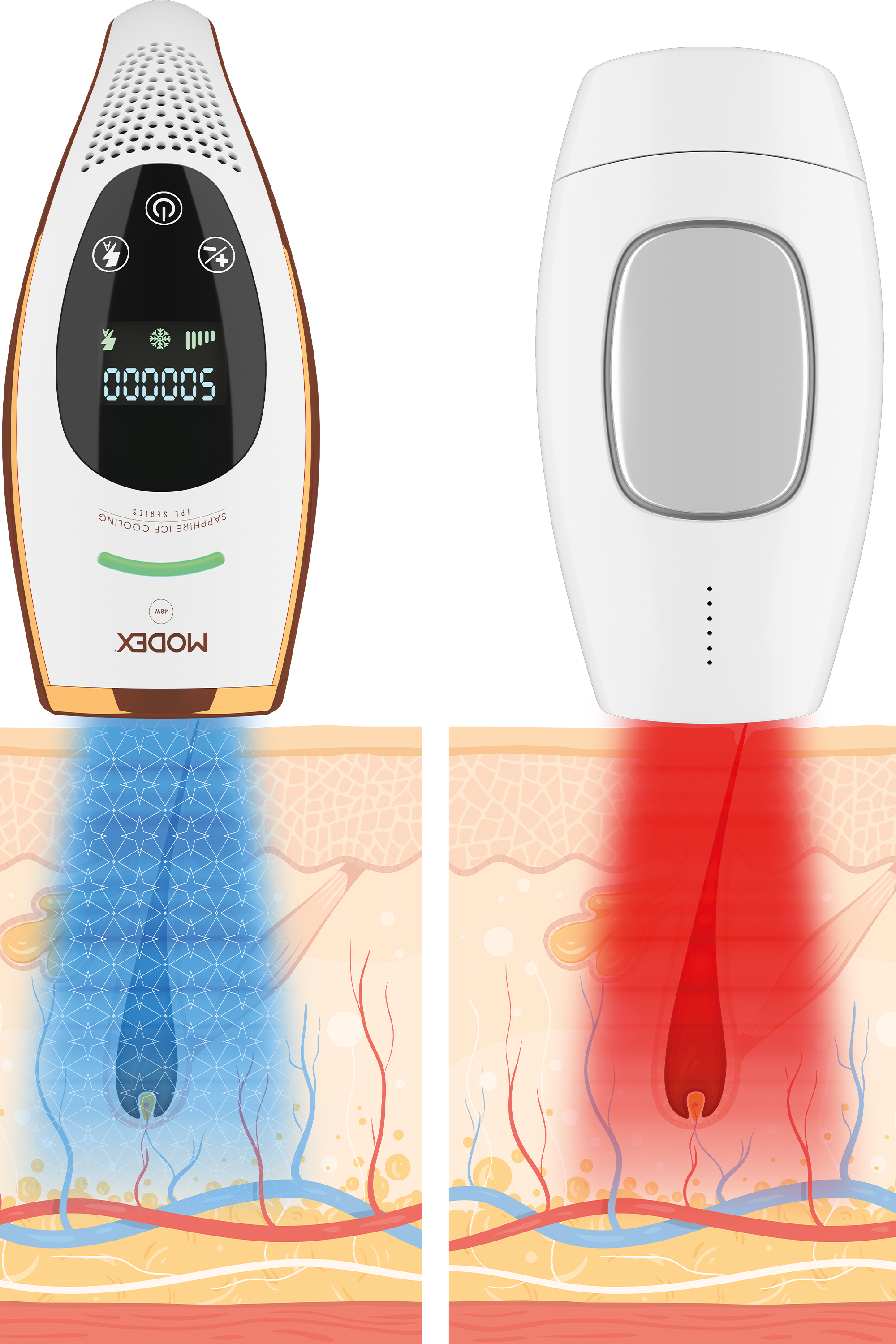 إزالة الشعر بالليزر IPL1100