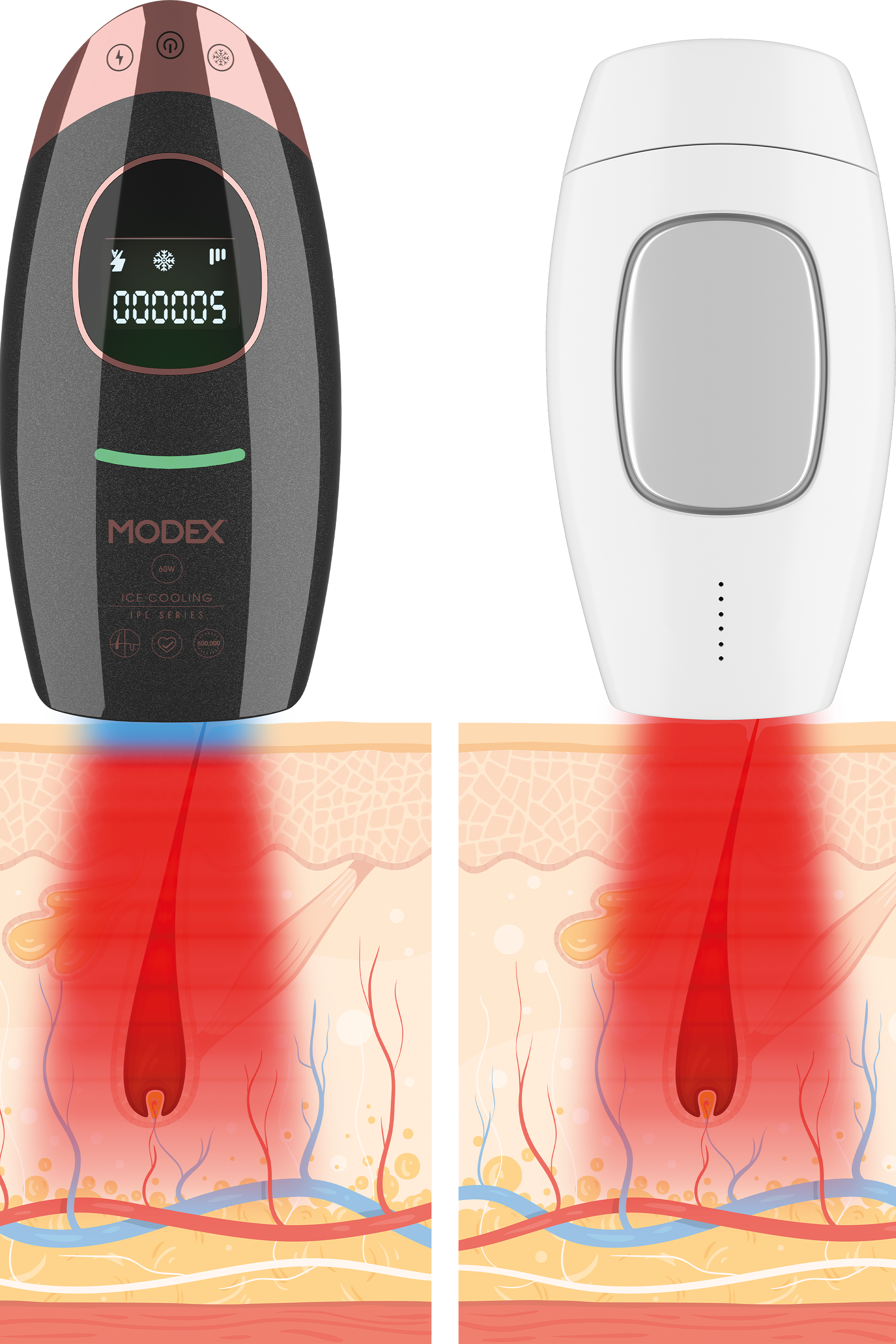إزالة الشعر بالليزر IPL1000