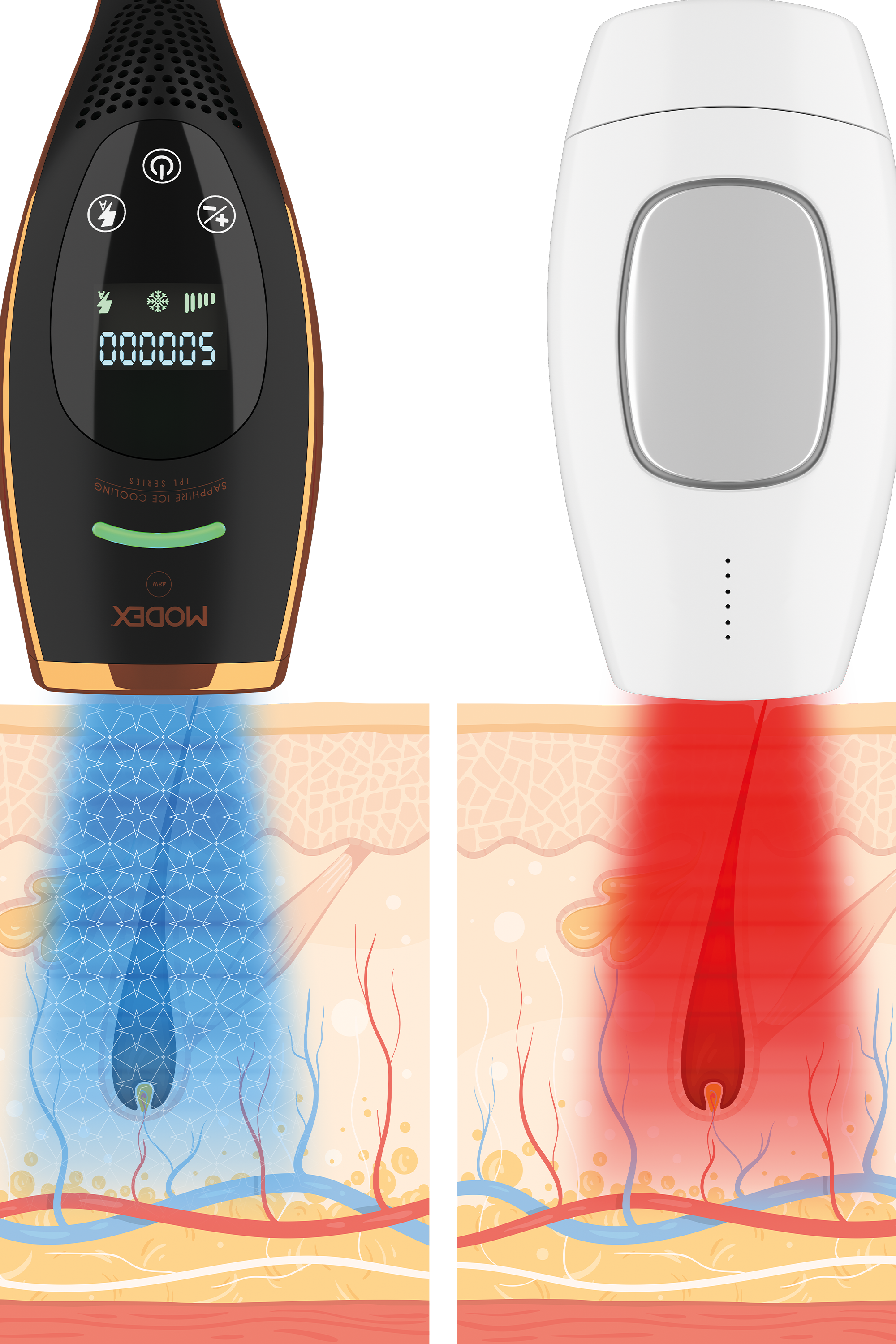 إزالة الشعر بالليزر IPL1100